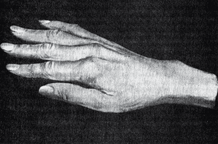 Слепок с руки Паганини